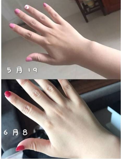 因为干货分享 如何让皮肤白得发光