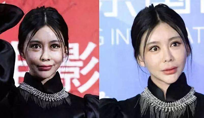 关键“整形脸”都不懂整成纯天然的关键是，摒弃苦苦挣扎感！
