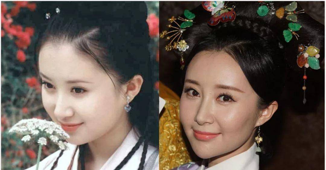 关键“整形脸”都不懂整成纯天然的关键是，摒弃苦苦挣扎感！