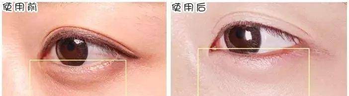 眼袋看完《都挺好》，我被苏大强的这一点惊到了