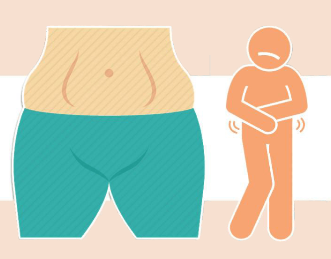 肝腹水与肥胖差别图片图片