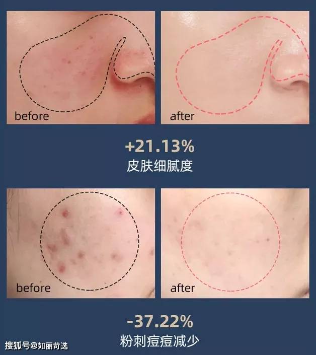 体重深扒：女生蜕变思路——不动刀8大具体案例，外在变化图解，大变活人魔法开场