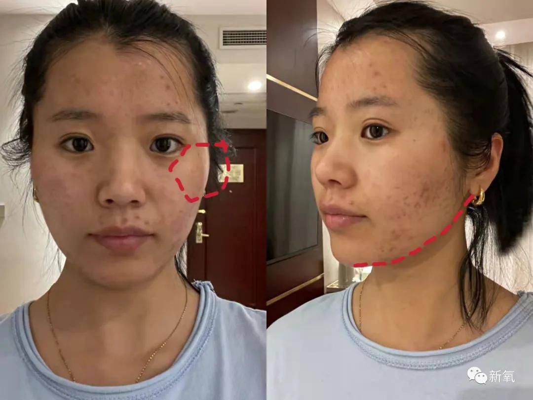 预算预算不过万，我是怎么送粉丝出道的？