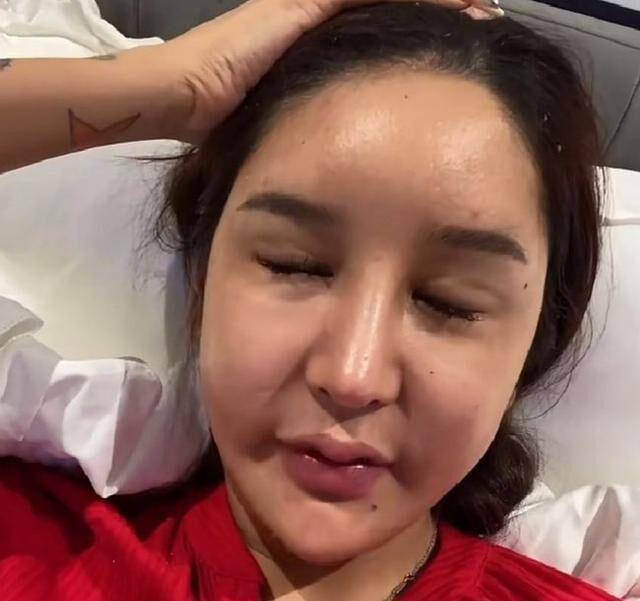 因为网络红人“桃花宝宝”，花费百万多次整容，手术之后笑容僵硬