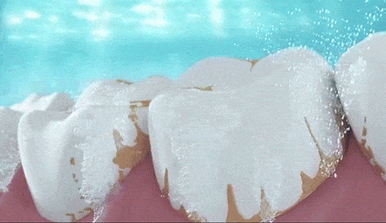 e8cc05b136bb4523b1bef3dfdb9e3aa3.gif