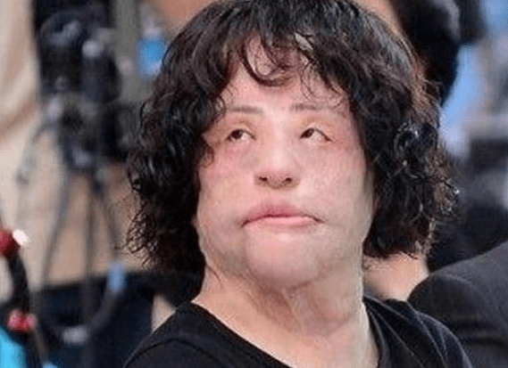 美貌整容狂人韩慧景：昔日美貌如花，整容后事业全毁，57岁遗憾离世