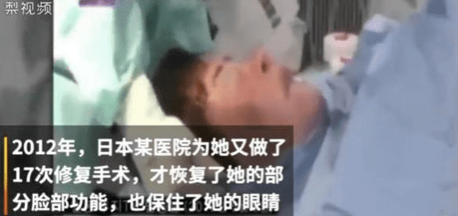 美貌整容狂人韩慧景：昔日美貌如花，整容后事业全毁，57岁遗憾离世