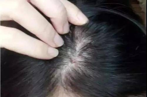 进行油性发质的女人，比用控油洗发水更重要的护发方法，你做到了吗？
