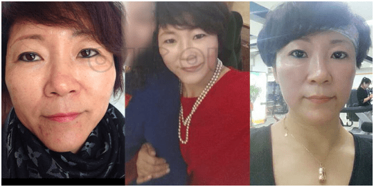 能量全面解析热拉提的功效与作用、热拉提plus做一次可以维持多久？