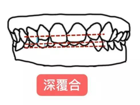 小天生图秒杀宋祖儿的天降紫微星，颜霸甜心可太绝了！