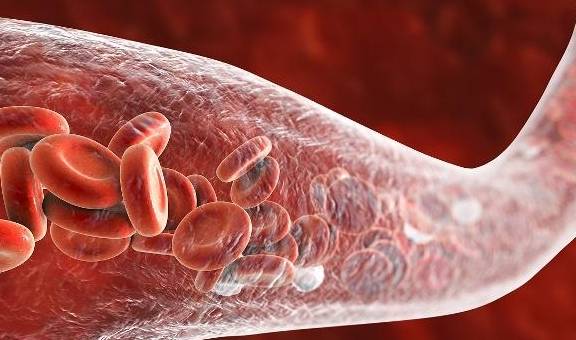 喝什么降低尿蛋白 1fd535c17e534e98ac2722e15bdc5688.jpeg