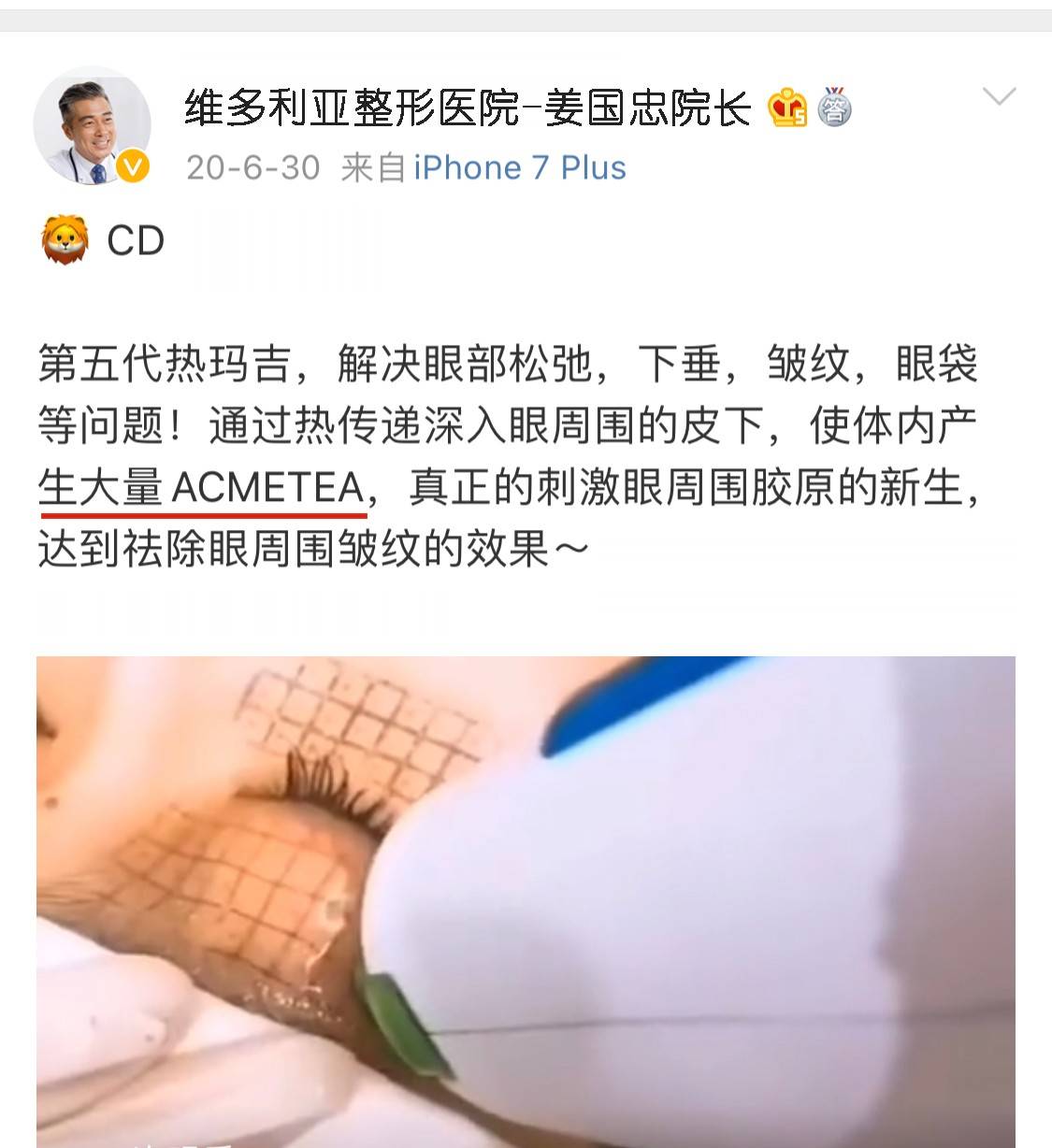 玛吉叭叭热玛吉主要起什么作用、热玛吉除皱美容效果？