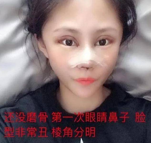 形象还记得13岁开始整容，花费上百万整容60次的女孩吗？现状令人唏嘘