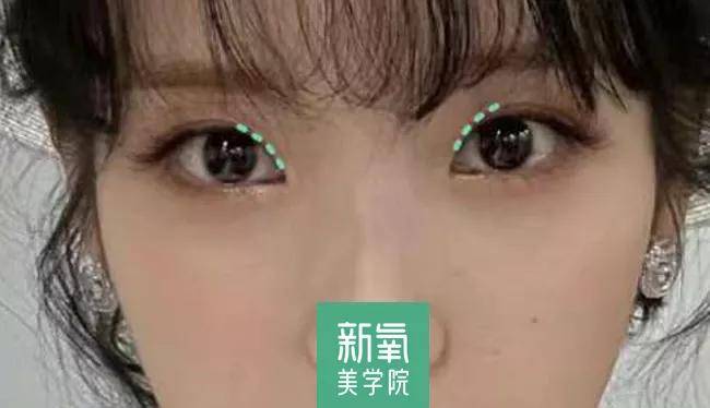 度数很多人都混淆了眯眯眼和小眼睛的区别