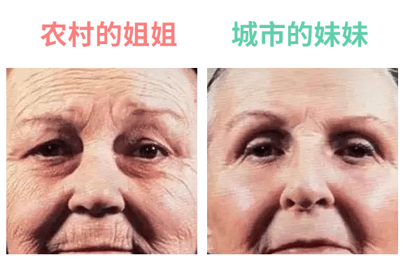 鱼尾纹抗衰老的意义在于哪里？面部28种皱纹有哪些？（抗皱方法精选）