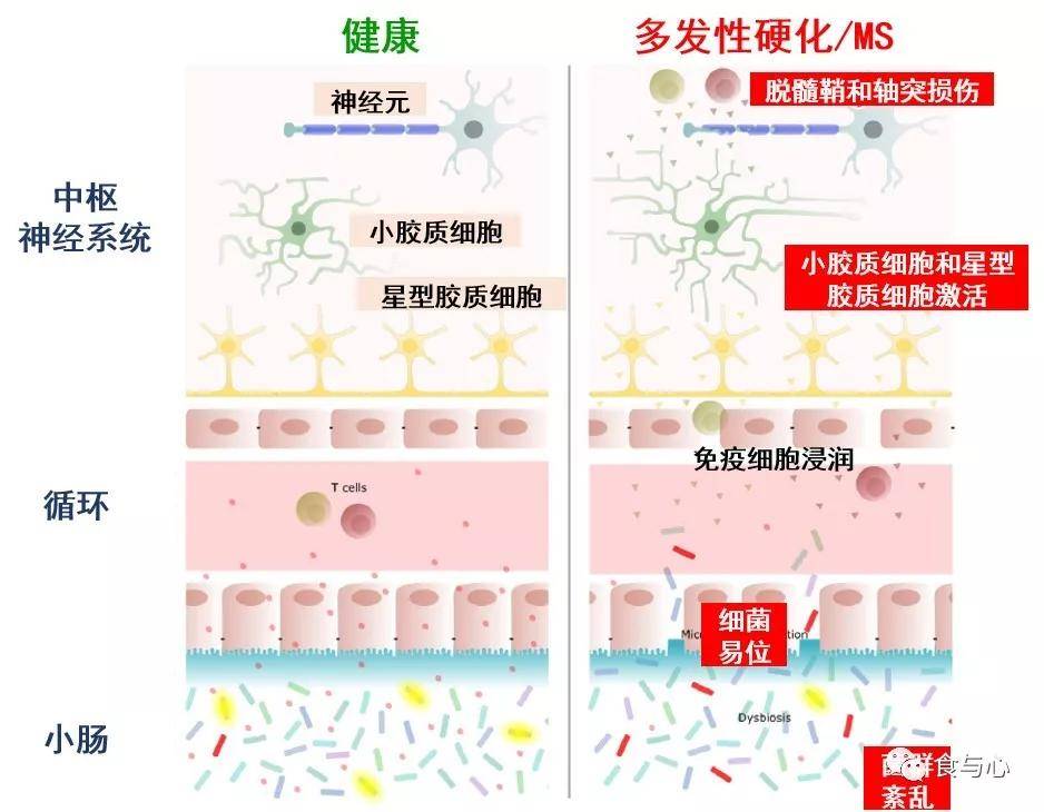 甲状腺|肠漏，你必须知道的热知识（二）