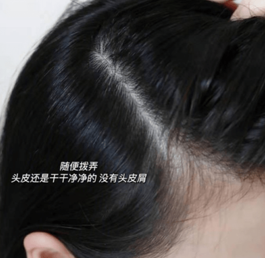 杠精杠精辣妈在线吐槽：海飞丝“雪花飘飘”，蜂花“脱发”神器
