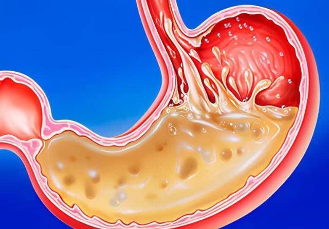 咋样快速消化 f51d6177e95944028587de7f0a97771a.jpeg