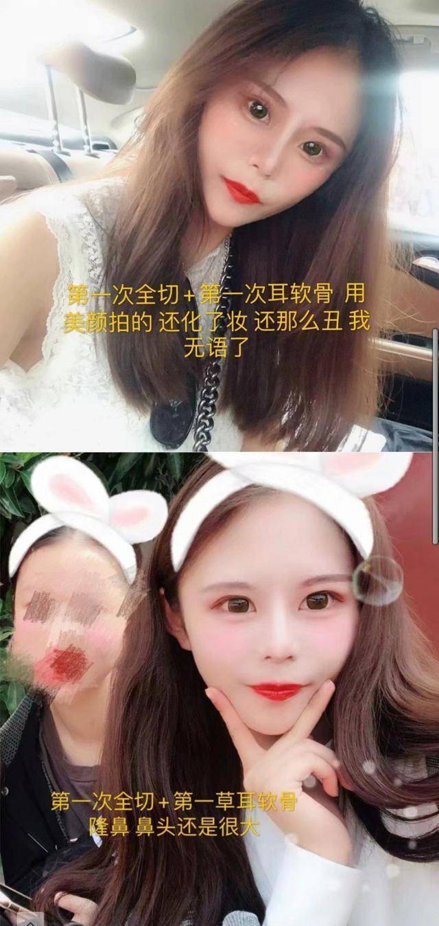 眼睛走火入魔！16岁女网红三年整容百次，眼睛占脸一半靠抽脂减重