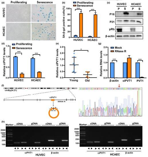 一区，IF=9.3|云序客户Aging Cell揭示circRNA调控内皮细胞衰老的分子机制