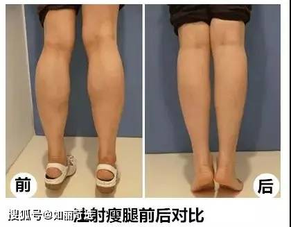 腰围酸了！男生的腿为什么比女生的还细？腿粗的妹子该怎么瘦腿？