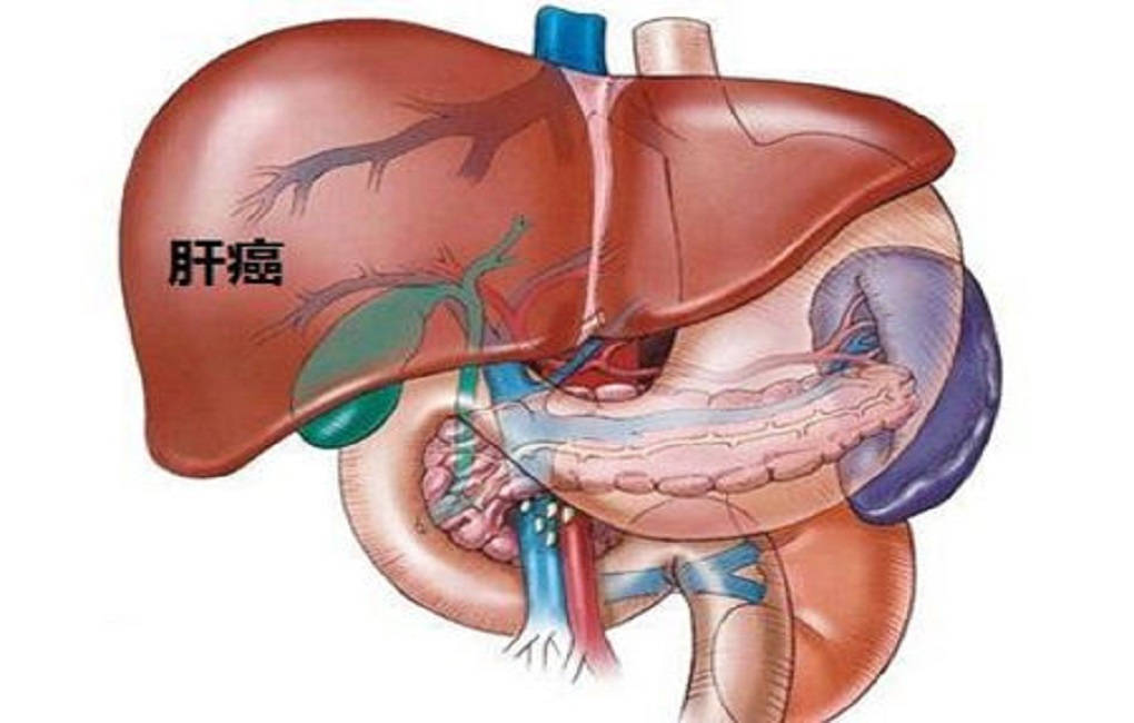 治疗|肝病一定会癌变吗？体检出这3种肝病不用治疗，别吓自己了