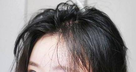 什么女性寿命和做头发的频率有关？头发长得快，说明什么问题？