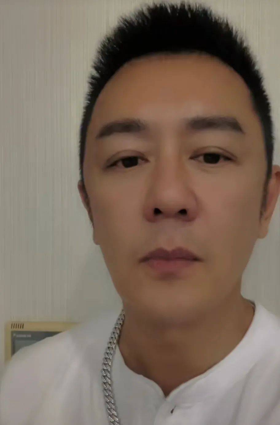 单眼皮明星割双眼皮对比，成龙刘恺威都逆袭，景甜秒变悲伤蛙