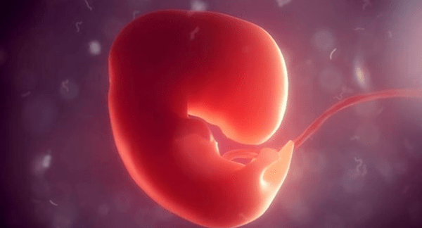怀孕一个月的胚胎图片图片