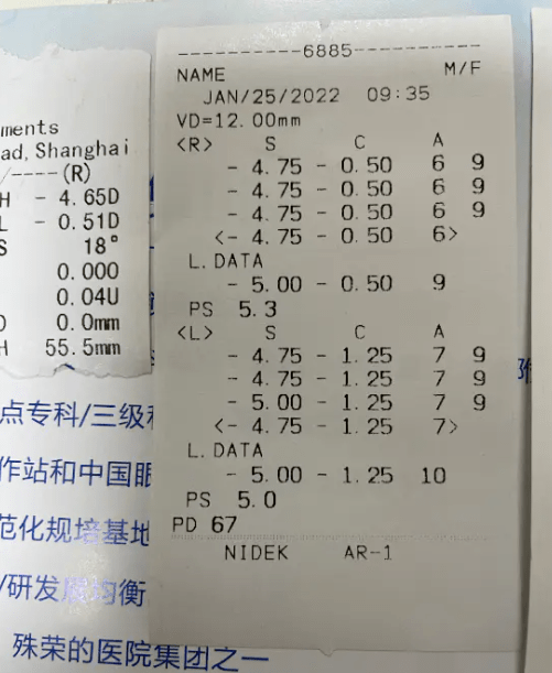 东莞全飞秒近视手术过程分享说说术后护理的注意事项