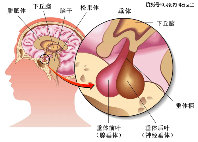 腺垂体功能减退症是什么？由不同病因引起的腺垂体全部或部分受损，可导