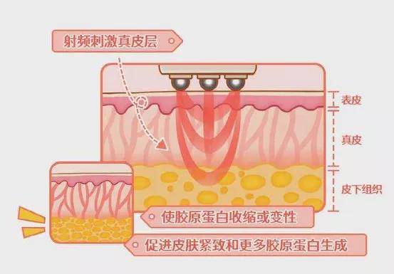 玛吉为什么她会从整形模板翻车成馒化代表?