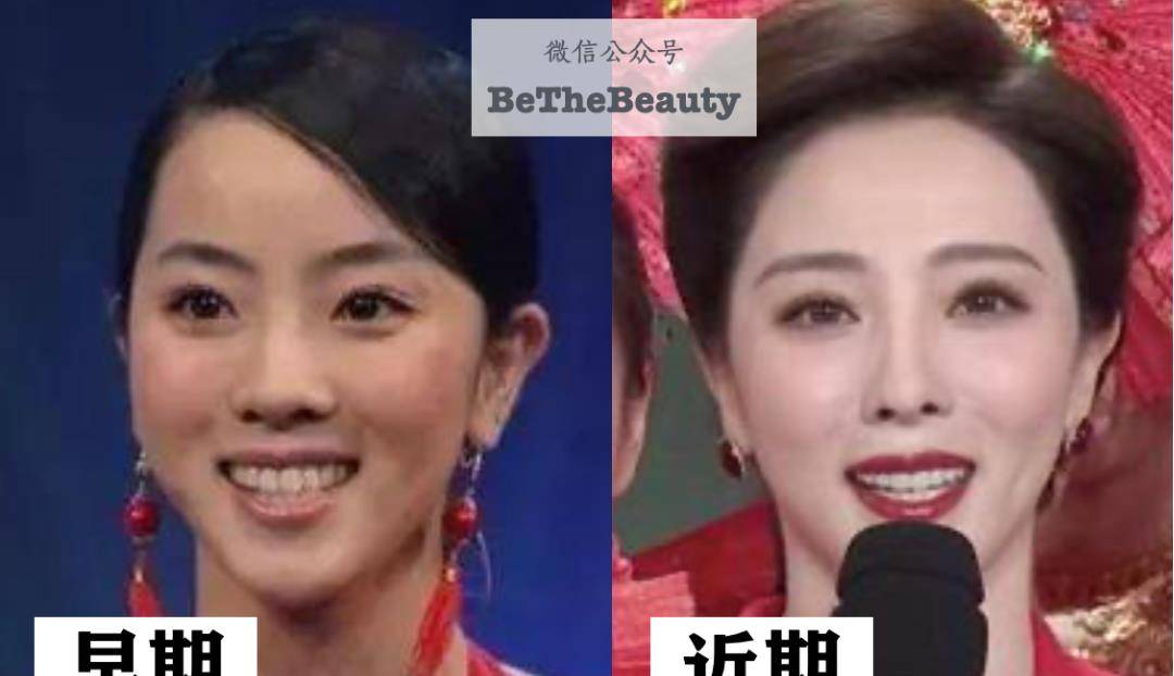 分析马凡舒为什么被说有「网红感」?「鉴整容」不如分析她的「变美教程」