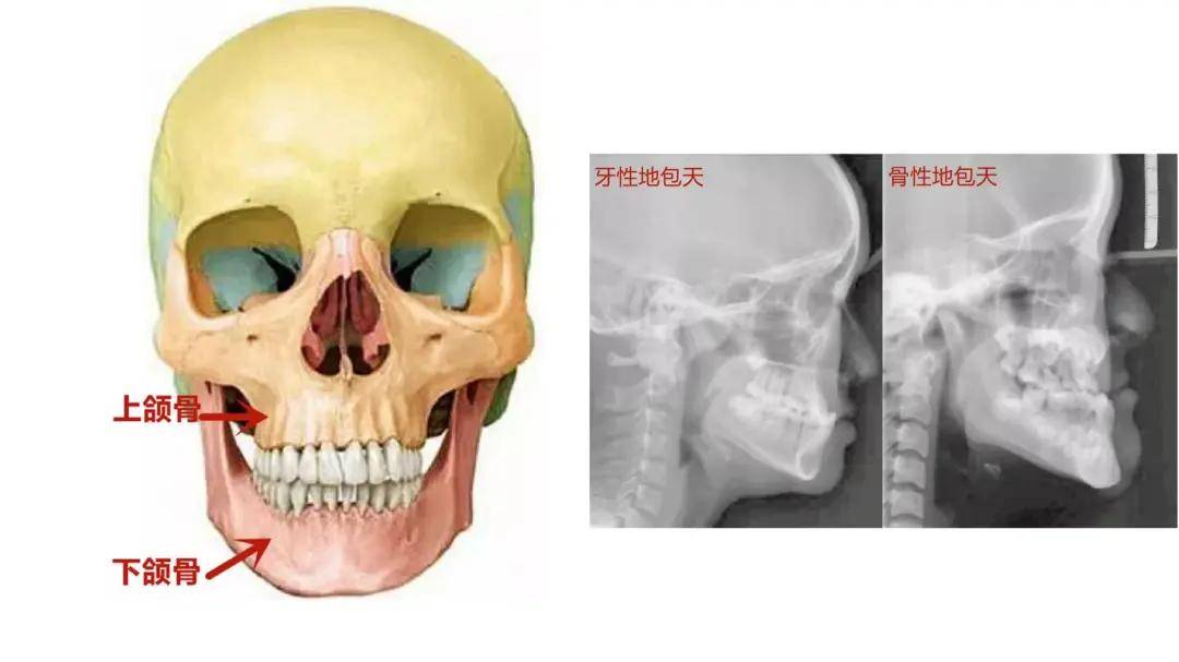 颌骨在哪里发育不良图片