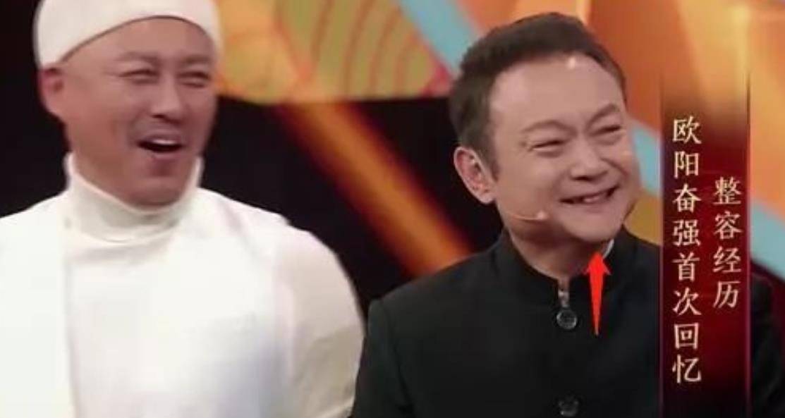 下巴明星频翻车医美需谨慎!有人脸变充气气球,有人下巴变天气预报