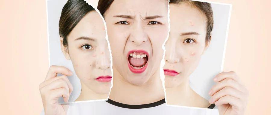 甲状腺|黛艺美拉丨天天挂在嘴边的“内分泌失调”到底是什么？这些疾病都与它有关！