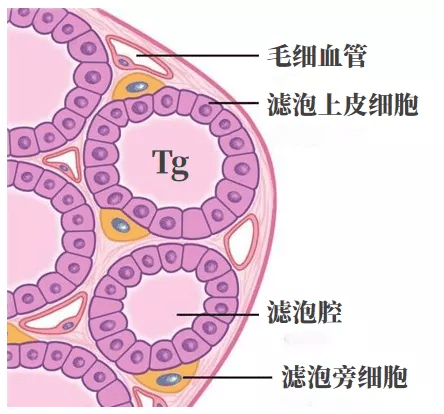 绝大部分tg是由甲状腺细胞合成并释放的,在分化型甲状腺癌术后,特别是