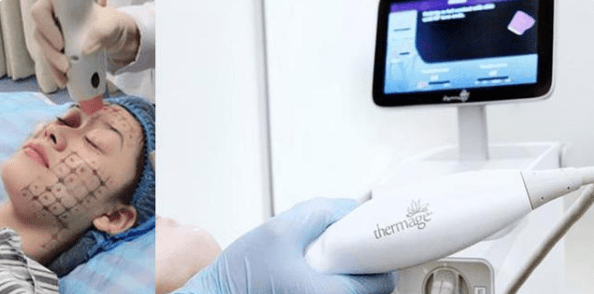 分析分析：热玛吉后多久可以打水光、做完热玛吉多久可以化妆~