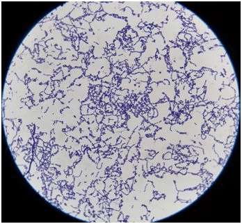 乙型溶血性链球菌手绘图片