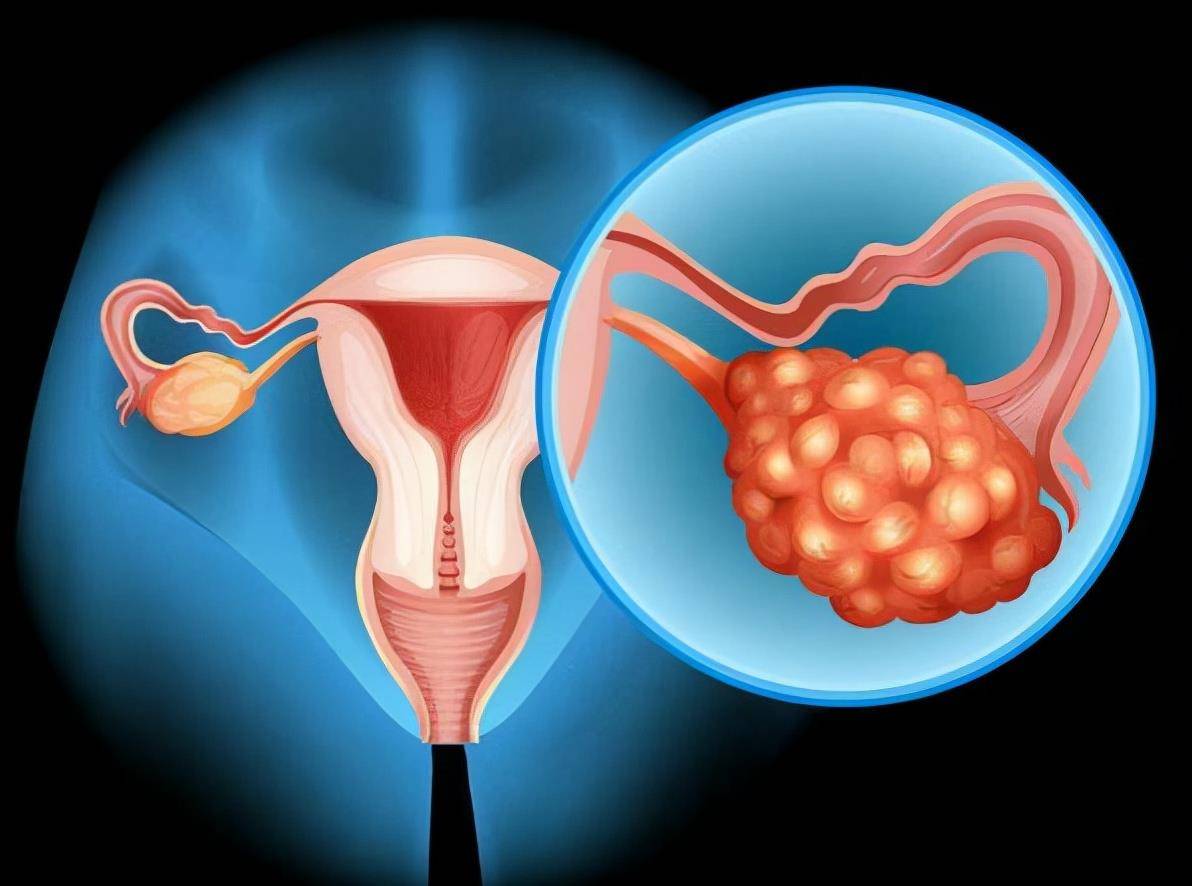 类人为什么有的女生体毛浓密，而有的却很光滑？这两类人哪种更健康？