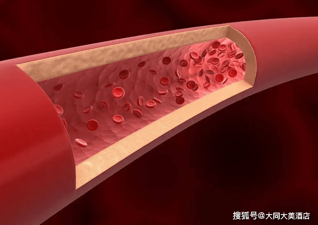 加重负担|早上的一件“长寿事”，不是喝水，也不是排便，让很多人没有注意