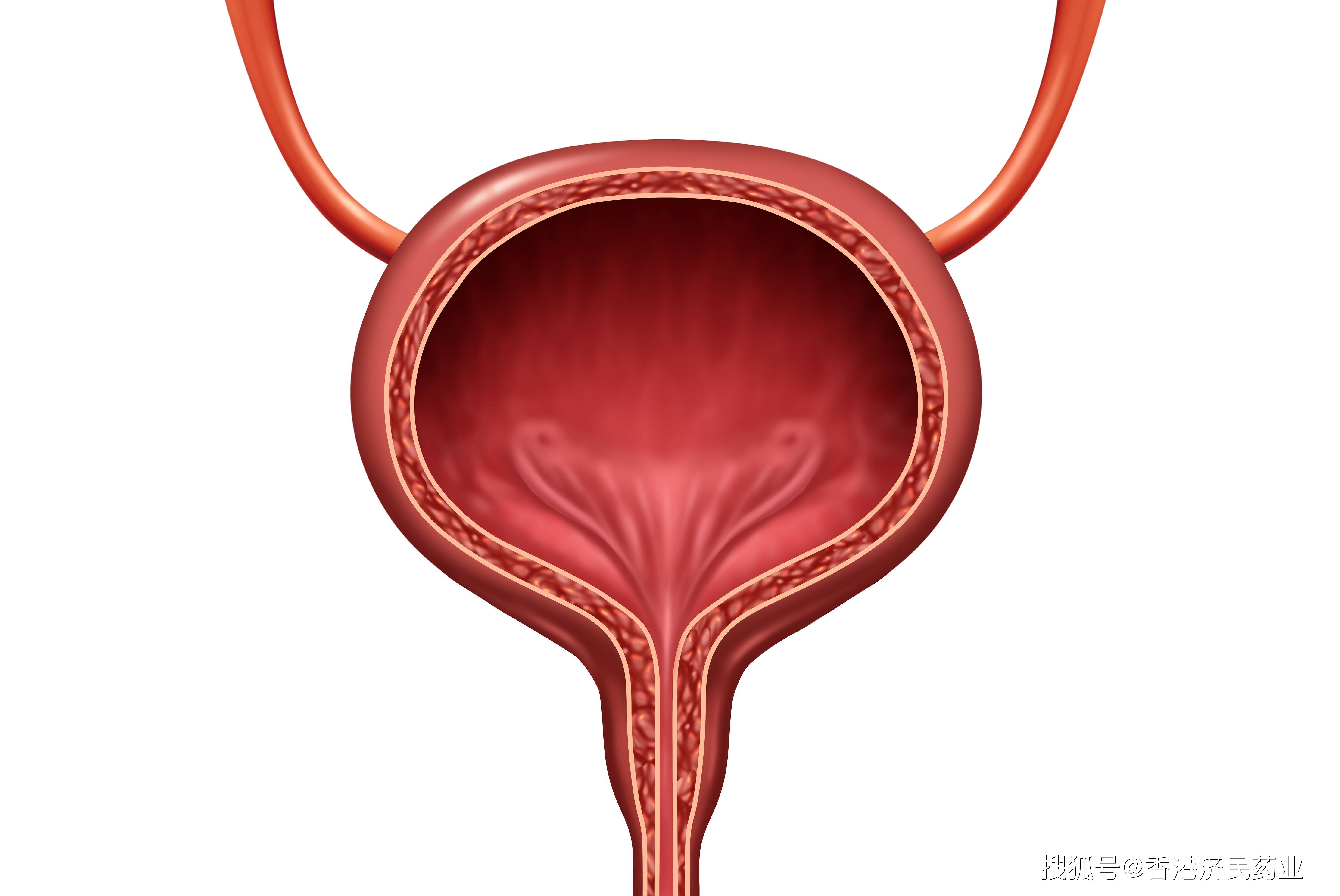 padcev在顺铂无效的肌层浸润性膀胱癌中显示出令人鼓舞的活性