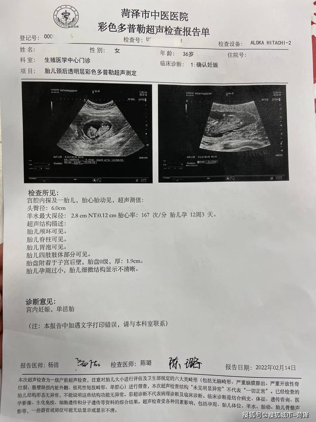 孕检报告单一个月图片