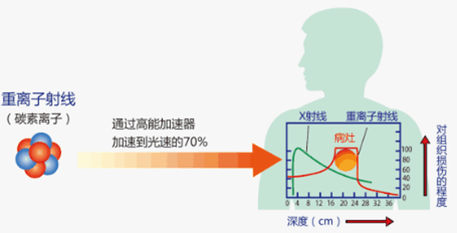 WLnad|30分钟“爆破”癌细胞！中科院造出“灭癌神器”，普通人能负担吗