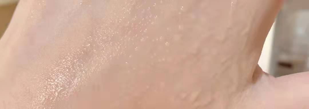 肤质油皮可以“用油护肤”吗？分享4款舒适清爽的护肤油，值得推荐