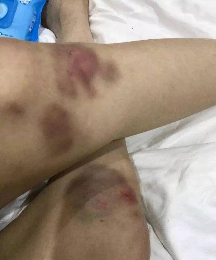 角色|张馨月：一年后终于换下创造101的置顶