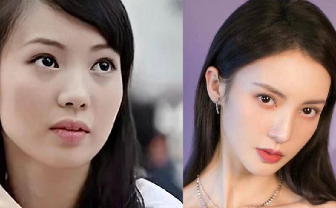 后遗症女明星为了变美，乱整鼻子留下的后遗症，至今悔恨终身