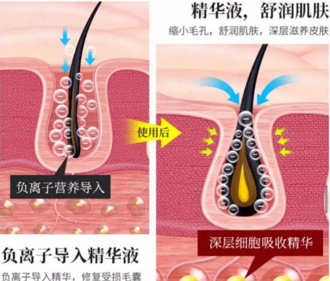 毛孔张嘉倪对自己“真狠”，把黑油皮变成“奶白肌”32岁看着像18少女
