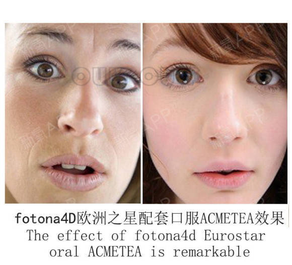 mmfontona 4d欧洲之星，欧洲之星的效果怎么样，mm们，请看过来