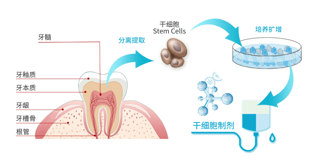 2000年,gronthos 等科学家从脱落的儿童乳牙中发现了牙髓干细胞.